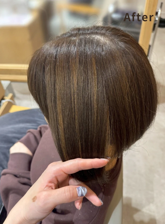 施術イメージ